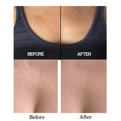 New Anti-Wrinkle Chest Pads Reusable Chest Lift Patch Self-Adhesive Chest Neck Pad Silicone Anti-Aging Wrinkle Remover Pad